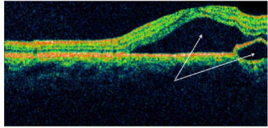 1766111605156310.png 1766111605156310.png